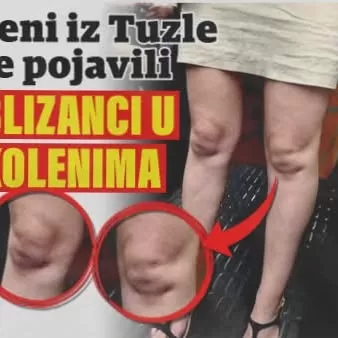 DECA U KOLENIMA TUZLANKE 👶